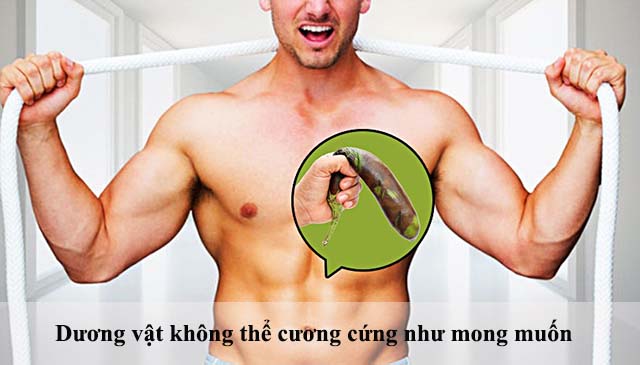 Triệu chứng rối loạn cương dương là dương vật không thể cương cứng