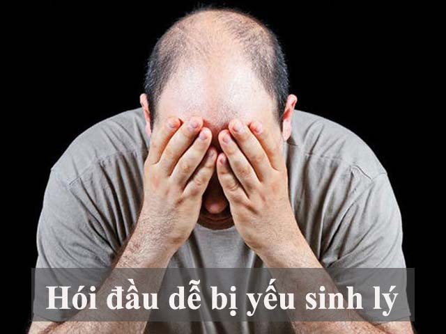 Hói đầu cũng là một triệu chứng yếu sinh lý