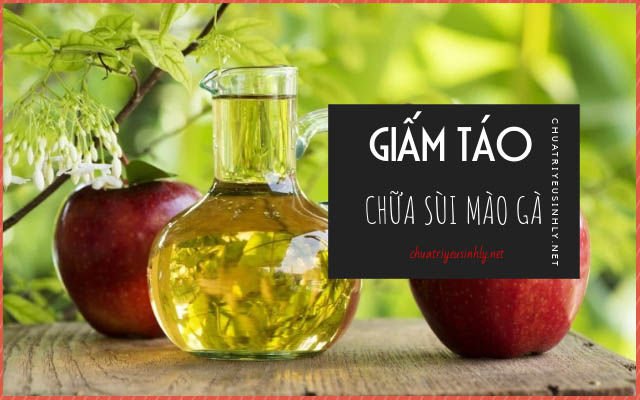 Chữa sùi mào gà bằng giấm táo