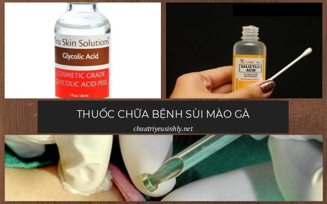 thuốc chữa sùi mào gà