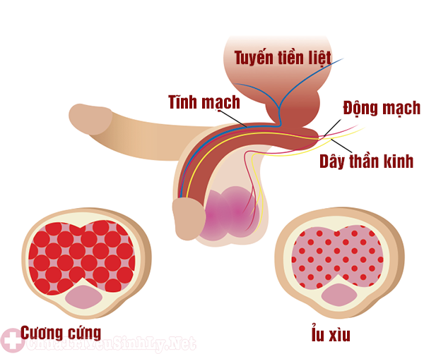 Bị liệt dương do sử dụng thuốc xịt điều trị bệnh xuất tinh sớm