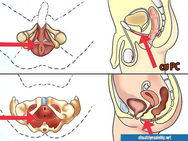 Luyện tập cơ PC điều trị rối loạn cương dương tại nhà