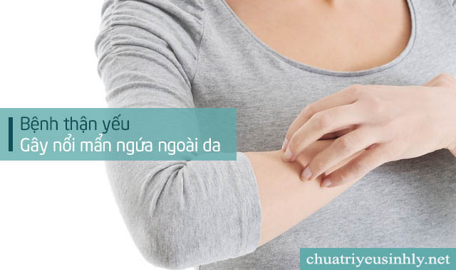 Ngứa ngoài da là dấu hiệu của bệnh thận yếu