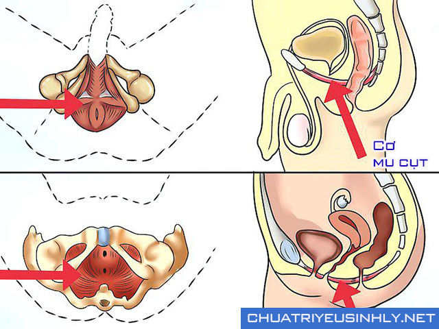Bài tập kegel giúp khắc phục rối loạn cương dương tại nhà