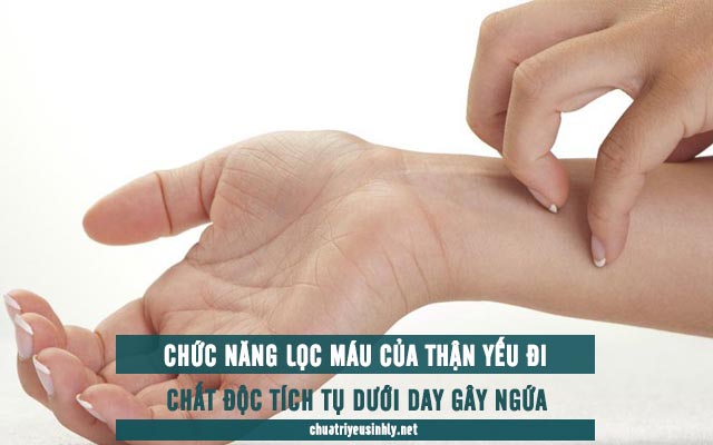 nguyên nhân thận yếu gây ngứa