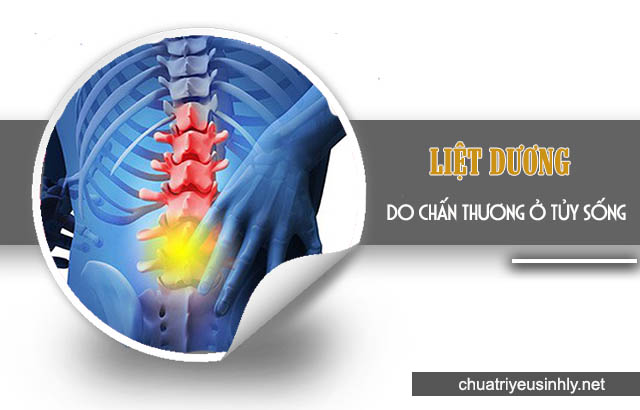 Chấn thương ở tủy sống là nguyên nhân gây bệnh liệt dương