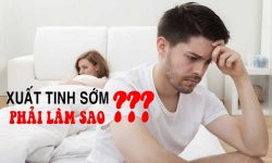 [Phỏng vấn chuyên gia] Cách điều trị xuất tinh sớm tại nhà với 5 phương pháp hiệu quả nhất 2021